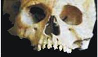 Косметическое контурирование зубов, 1 век до н.э.