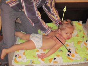 Два метода мануальной терапии грудного отдела у новорождённого 2
