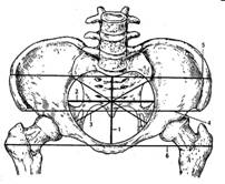Рисунок 119 - 2. Овальная конфигурация нормальных тазовых костей (вид сверху)