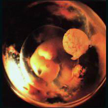 Эмбрион 4 недели