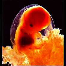 Эмбрион 7 недель