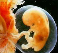 Эмбрион 8  недель