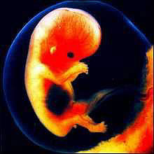 Эмбрион 9  недель