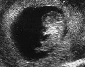 Эмбрион 9 недель