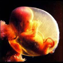 Эмбрион мальчик 10  недель