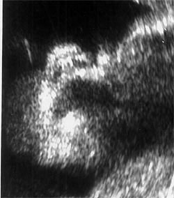 Беременность, портрет плода, 36 неделя